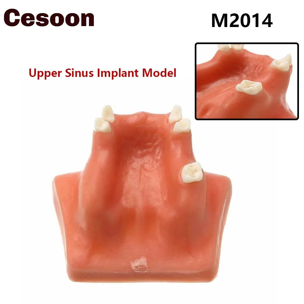 

Моделирование зубов для зубной практики, импланты для подтяжки верхней челюсти и синуса, восстанавливающая смола для мастики, медицинское обучение, демонстрационные модели