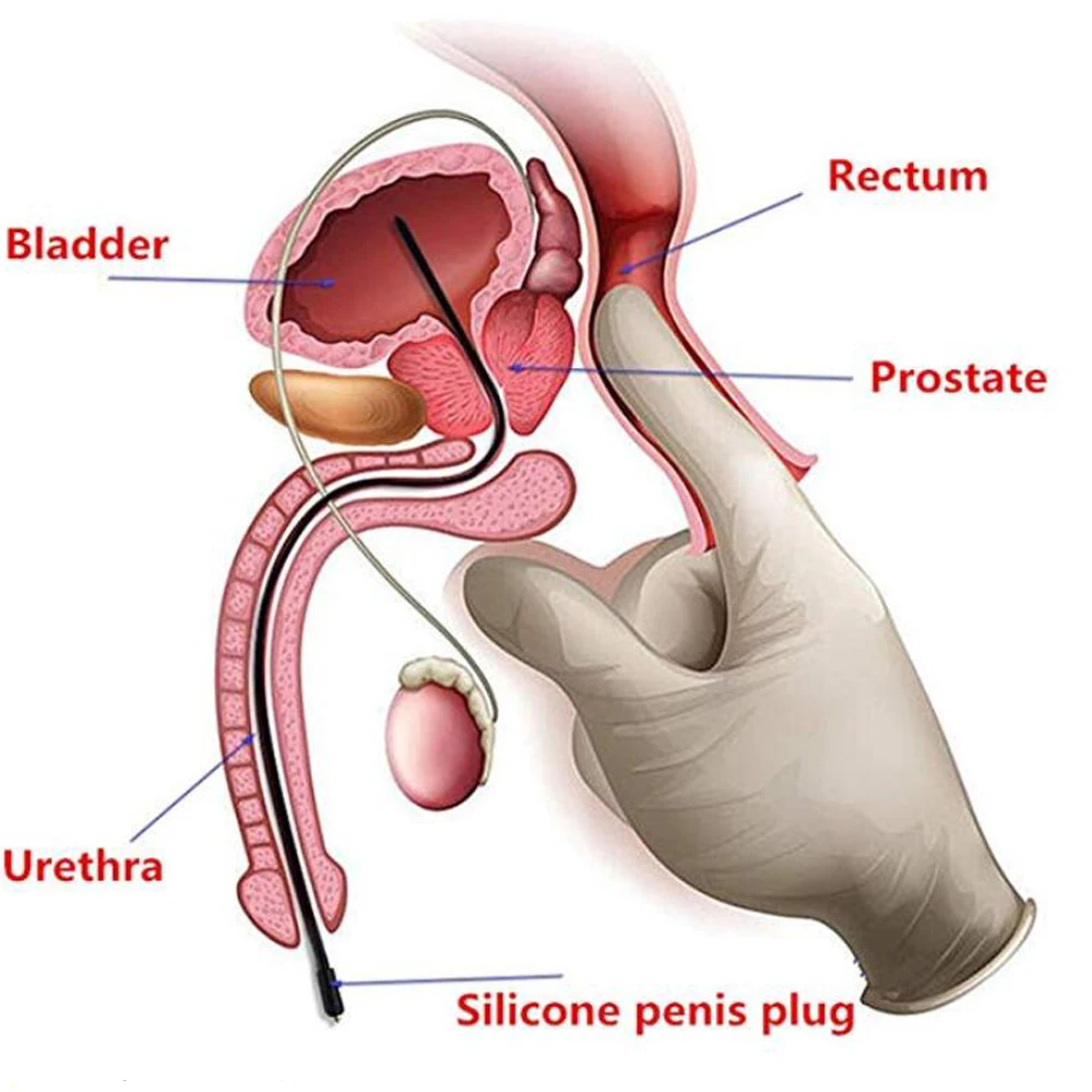 Катетер расширитель пробка для пениса 250 мм электрошоковый аксессуар секс