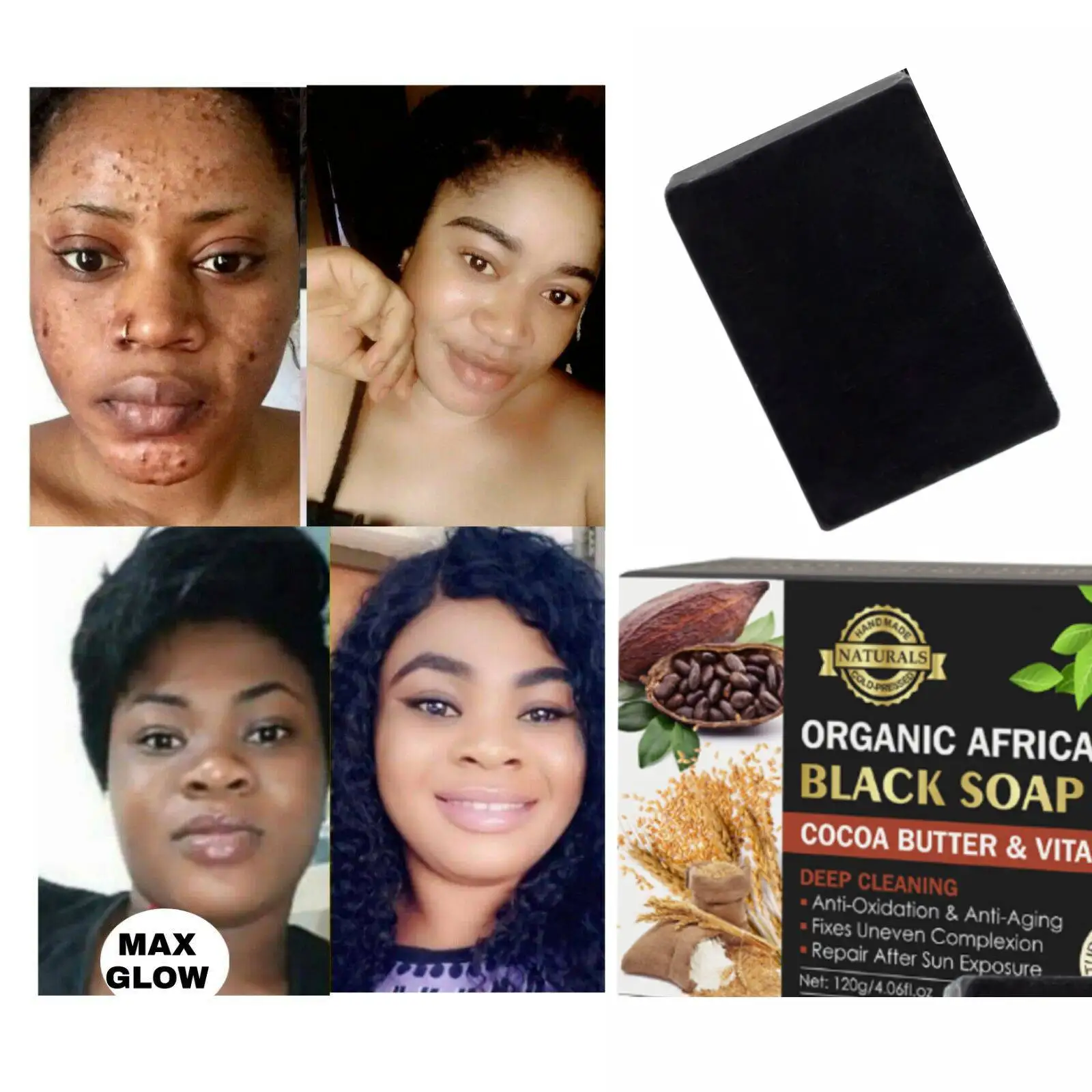 

Face Lightening black soap ,Even Skin dark spots remover, Glowing, Fast action