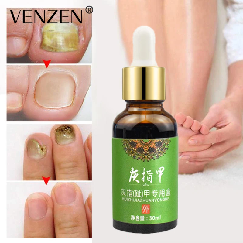

PUWEIKE Nail Fungal Treatment Feet Care Essence Nail Foot Whitening Toe Removal Gel Anti Infection Paronychia Onychomycosis