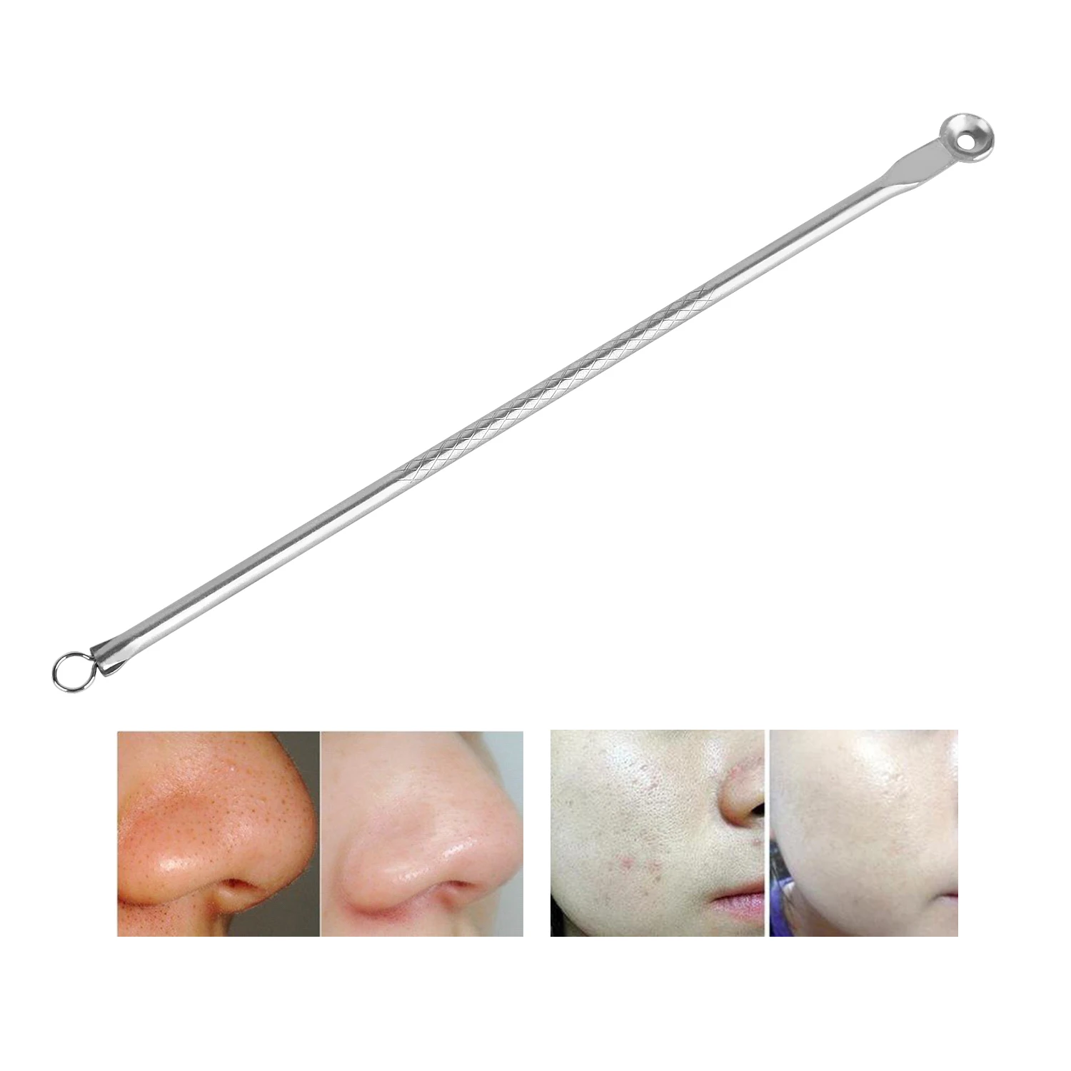 1 шт. Серебристые иглы для удаления черных точек из нержавеющей стали ухода за