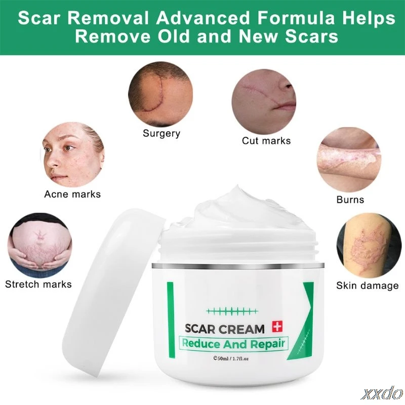 

50ml Scar Removal Cream Acne Treatment Stretch Marks Burning Repair Balm