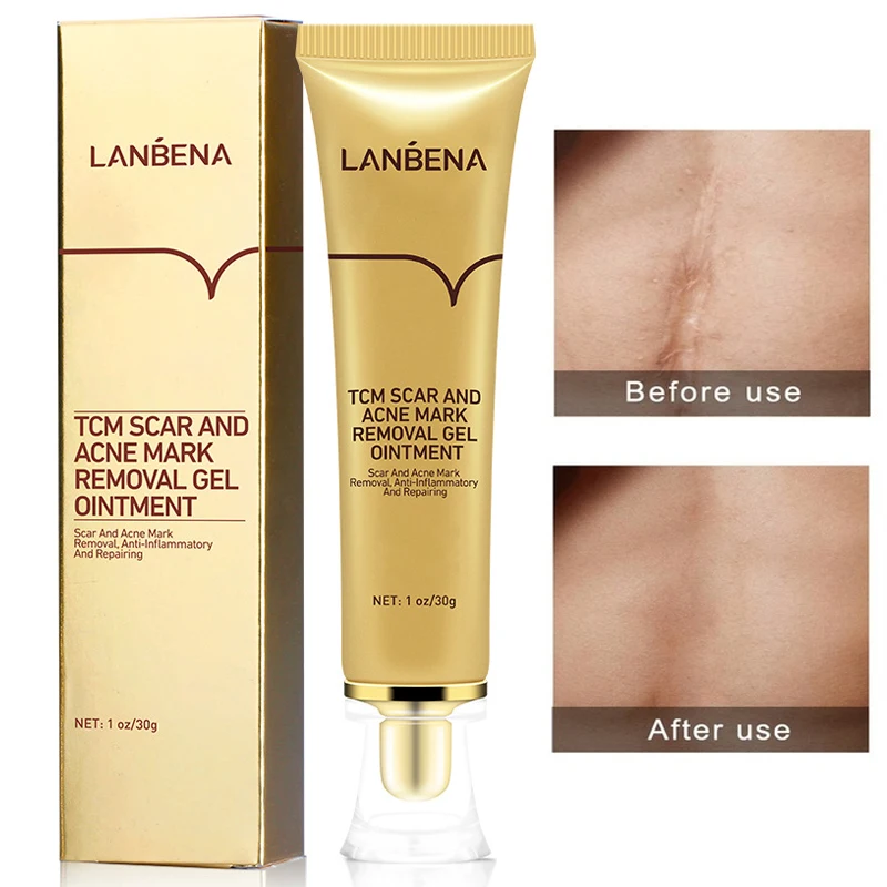 Крем для удаления шрамов от акне 30 г крем лица гель восстановления контроль