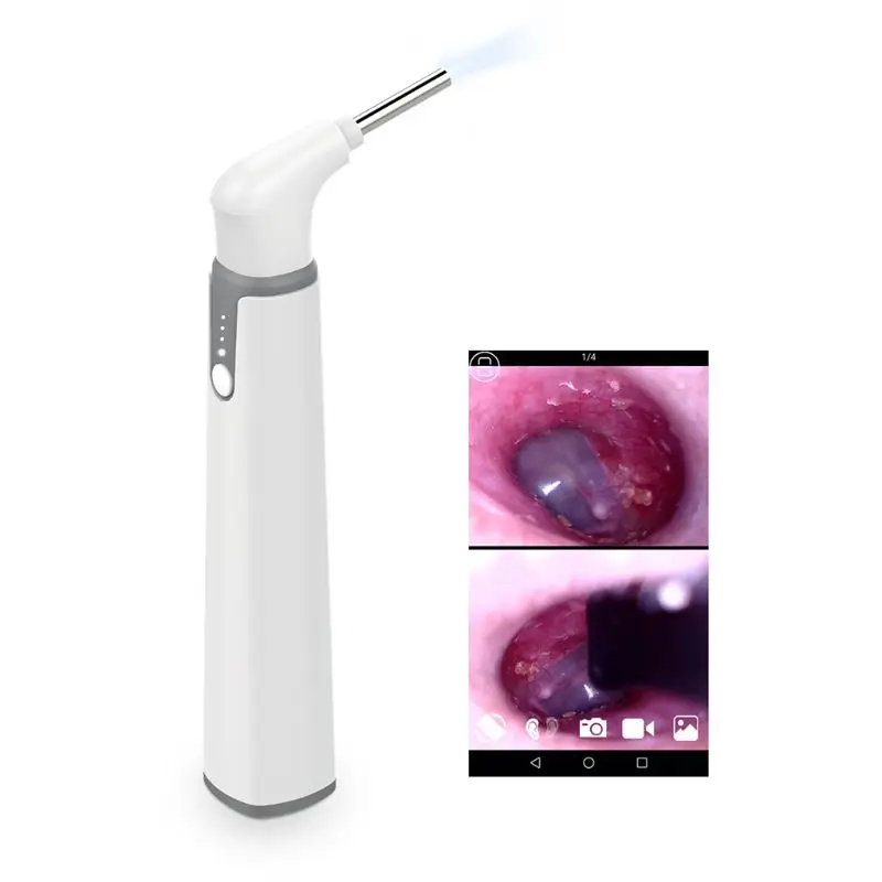 Wifi Smart Otoscope очиститель ушей Ушная ложка наушник 3 9 мм эндоскоп Camrea|Детали и