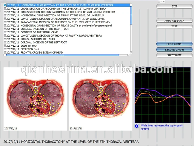 

Multi-language Bioresonance 8d Lris Nls Health Analyzer