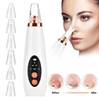 Инструмент для удаления черных точек вакуумный аппарат для очистки пор носа, удаление черных точек, акне, прыщей, для удаления, всасывающий, инструмент для красоты лица, спа