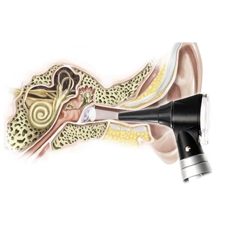 Профессиональный ENT диагностический комплект Портативный эндоскоп офтальмоскоп