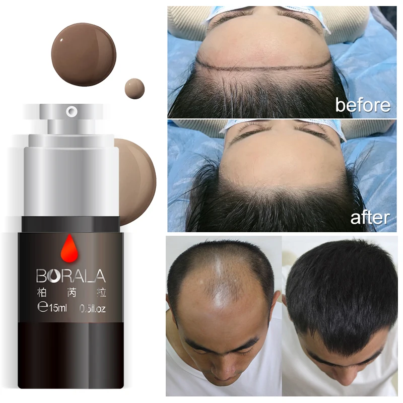 

AIMOOSI Borala Tattoo Hairline Pigment For Beauty Health Hair Growth Paint Hair Scalp Treatment Anti Hair Loss Products