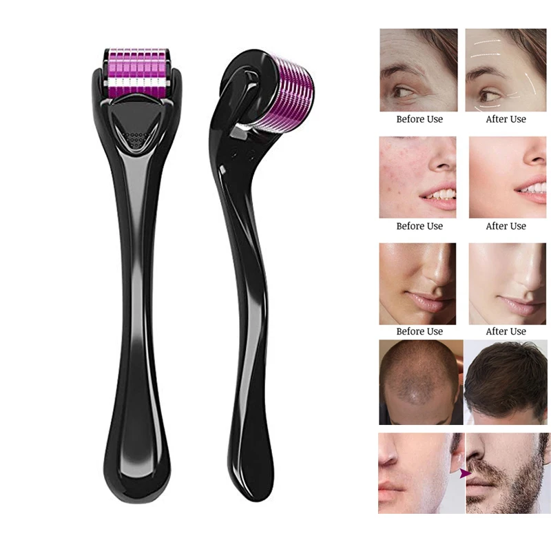 Derma Roller DRS 540 Micro Needle Skin Care Treatment Scalp Hair Beard Re- Growth Anti Wrinkle Acne Scar Agulha Mento Mezoroller
Derma Roller DRS 540 Micro Needle Skin Care Treatment Scalp Hair Beard Re- Growth Anti Wrinkle Acne Scar Agulha Mento Mezoroller