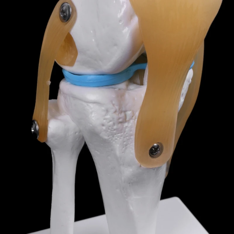 

Human Anatomical Knee Joint Flexible Skeleton Model Learning Aid Anatomy