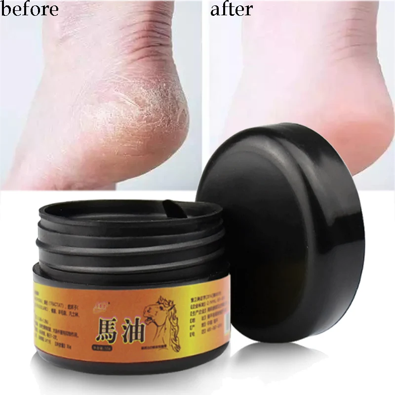 Уход за кожей конского масла крем для ног анти Потрескивающий пилинг