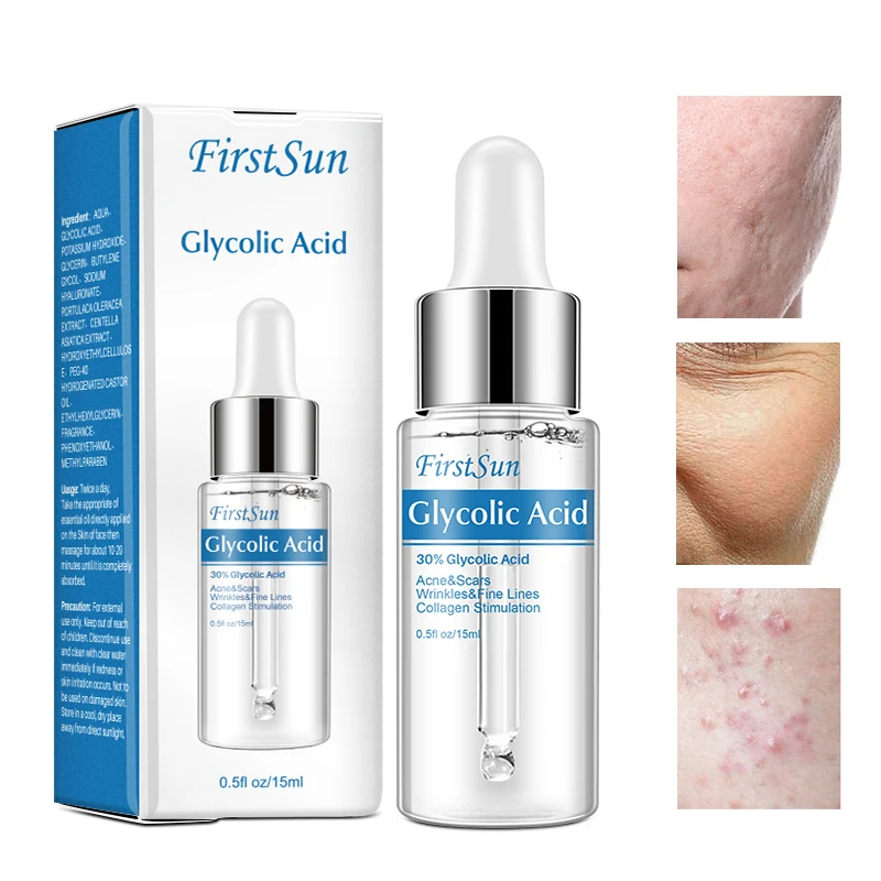

30% Glycolic Acid Facial Serum Improve Acne Scar Brighten Whitening Anti-Wrinkle Anti-Aging Tighten Fine Lines Face Essence 15ml