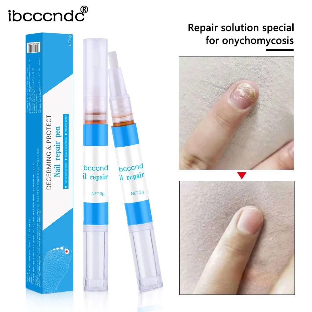 Ibcccndc Nail Care Solution Pen Go Gray Biofilm a Polish Remove Pencil | Красота и здоровье