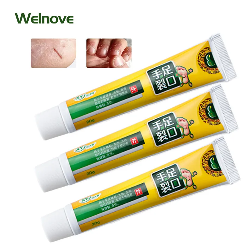 

3 шт., увлажняющий крем для рук и ног, против трещин