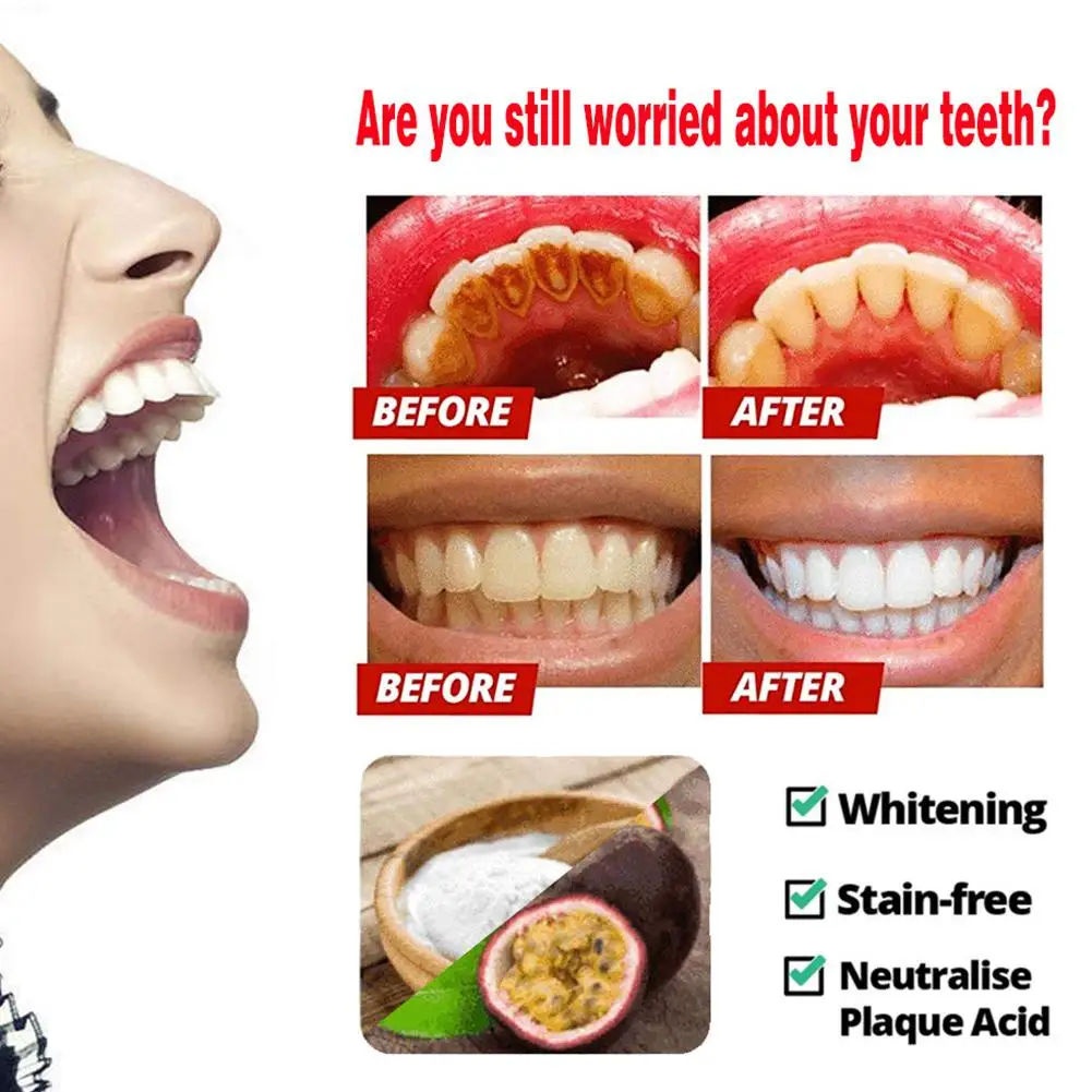 Яркая Гламурная Сода зубная паста пресс тип интенсивное удаление пятен