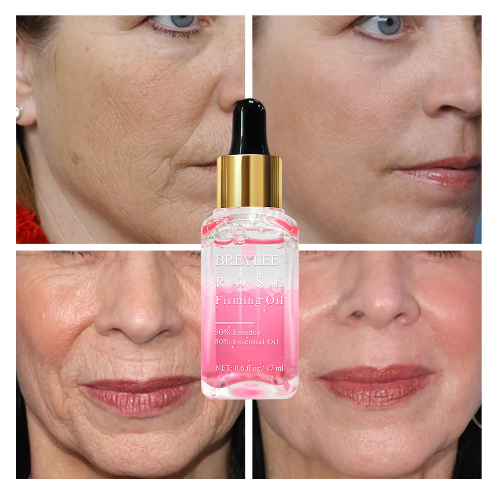 Розовая Гиалуроновая кислота укрепляющее эфирное масло Neroli отбеливающая