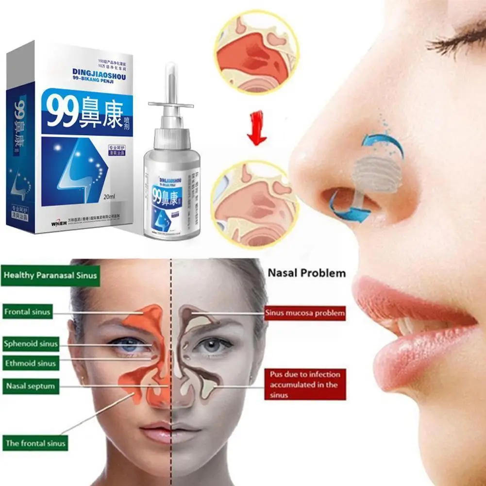 

20ml Herb Spray Nasal Spray Rhinitis Treatment Chinese Sinusitis Nose Chronic Traditional Nose Care Spray Rhinitis Medical M5X9