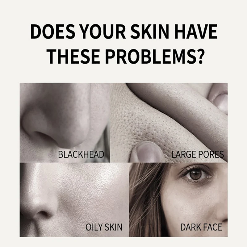 

Reduces Blackheads Pores Acne Oily Skin Pure Dead Sea Mud Mask Moisturizing Mask