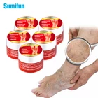 5 шт мазь для варикозных вен васкулит флебит Спайдермен лечение ног крем варикоза ангиит удаление из трав, медицинская штукатурка