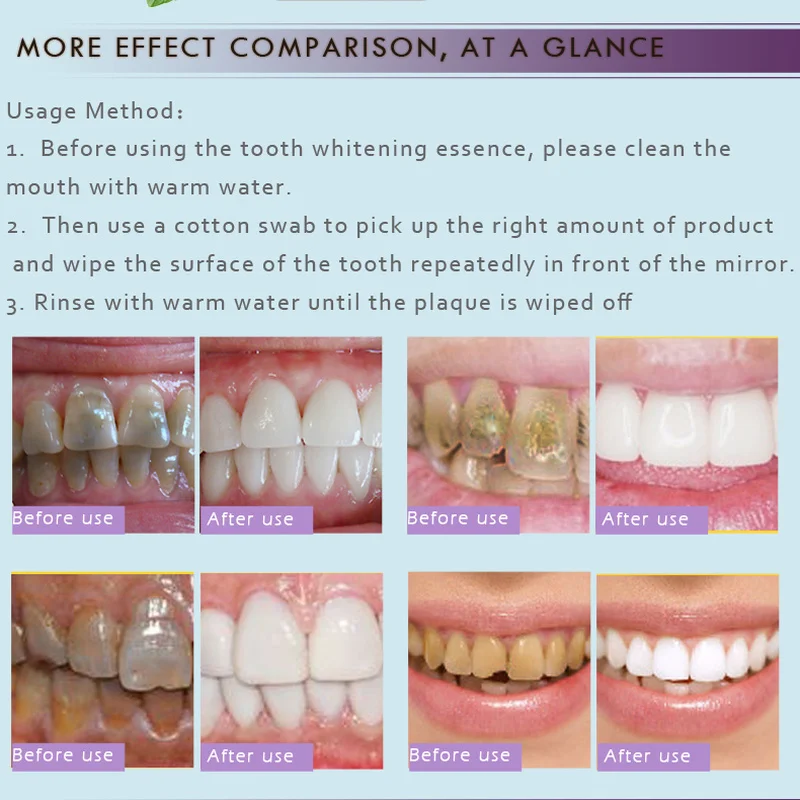 

RtopR Teeth Oral Hygiene Essence Whitening Essence Daily Use Effective Remove Plaque Stain Cleaning Product teeth Cleaning