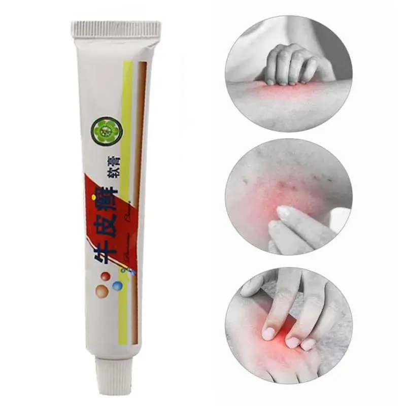1pc Dermatologist Skin Ringworm King Ointment Genuine Psoriasis Sweat Spot Chinese Medicine Care | Красота и здоровье