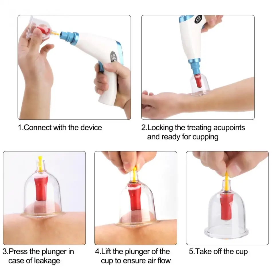 

Electric Vacuum Chinese Suction Body Cupping Therapy Kit Lymph Drainage Pain Relief Massage Anti Cellulite Cupping Device Set