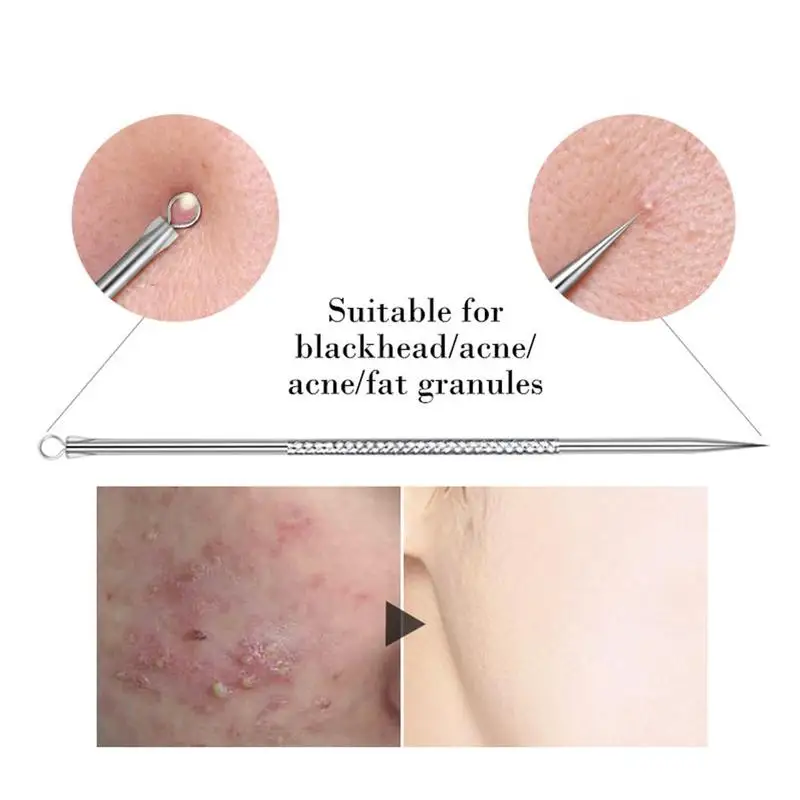 4 шт. набор для удаления чёрных точек и прыщей на лице|Устройство ухода за кожей