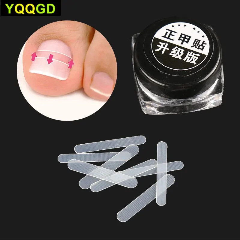

10Pcs/Set Nail Art Ingrown Correction Sticker Fixer Paronychia Recover Toenail Patch Corrector foot care Pedicure Tool
