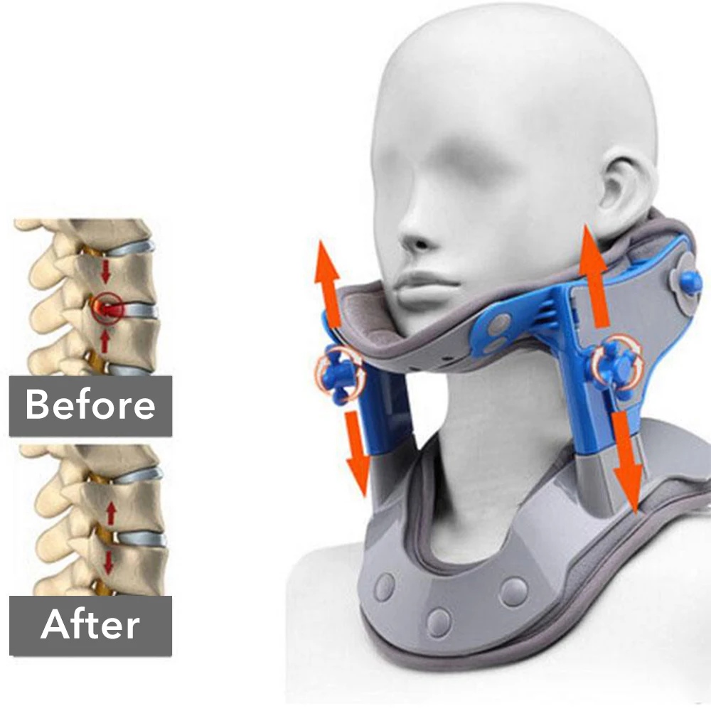 

Heating Neck Collar Correction Repair Neck Cervical Traction Apparatus Moxibustion Heat Treatment Of Cervical Spine Massager
