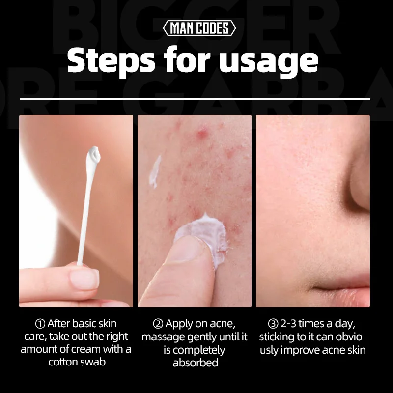 MANCODES 10g Acne Treatment Face Cream Natural Plant Formulas Anti Oil Control Shrink Pores Scar Remove Care | Красота и здоровье