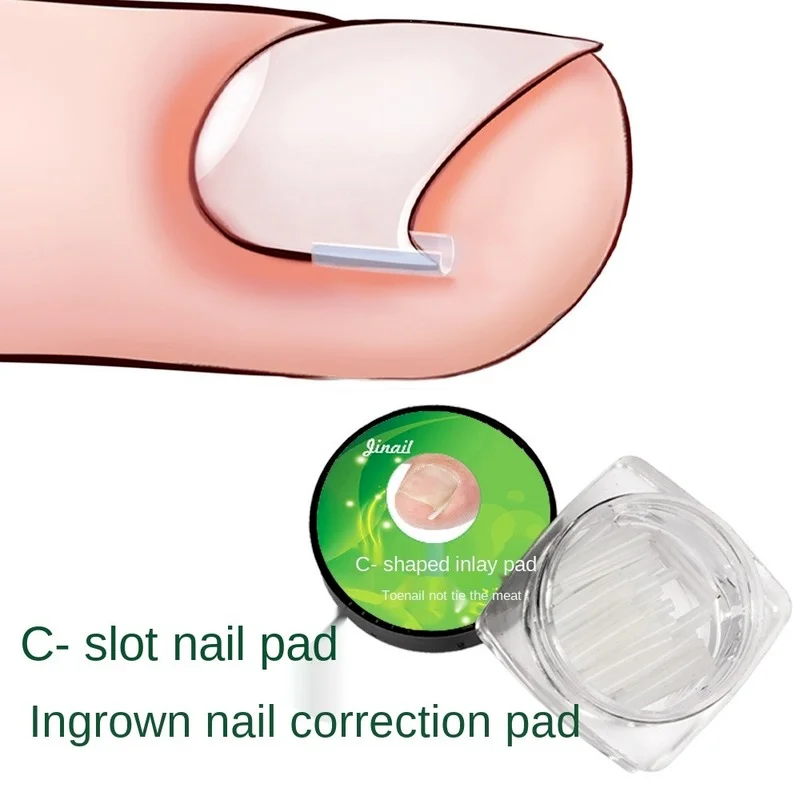

10pcs/set Ingrown Nail Pad Ortho Nail Filling Nail Groove Pad Ingrown Nail Corrector Ingrown Nail Artifact