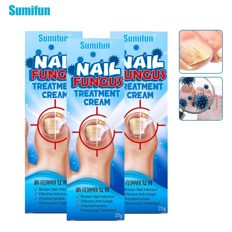 

3box Fungal Nail Treatment Anti-Fungal Nail Infection Herbal Toe Fungus Foot Repair Cream Onychomycosis Healthy Herbal Nail Care