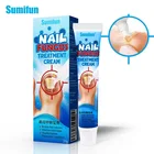 Мазь для лечения Ногтей Эфирная, 20 г