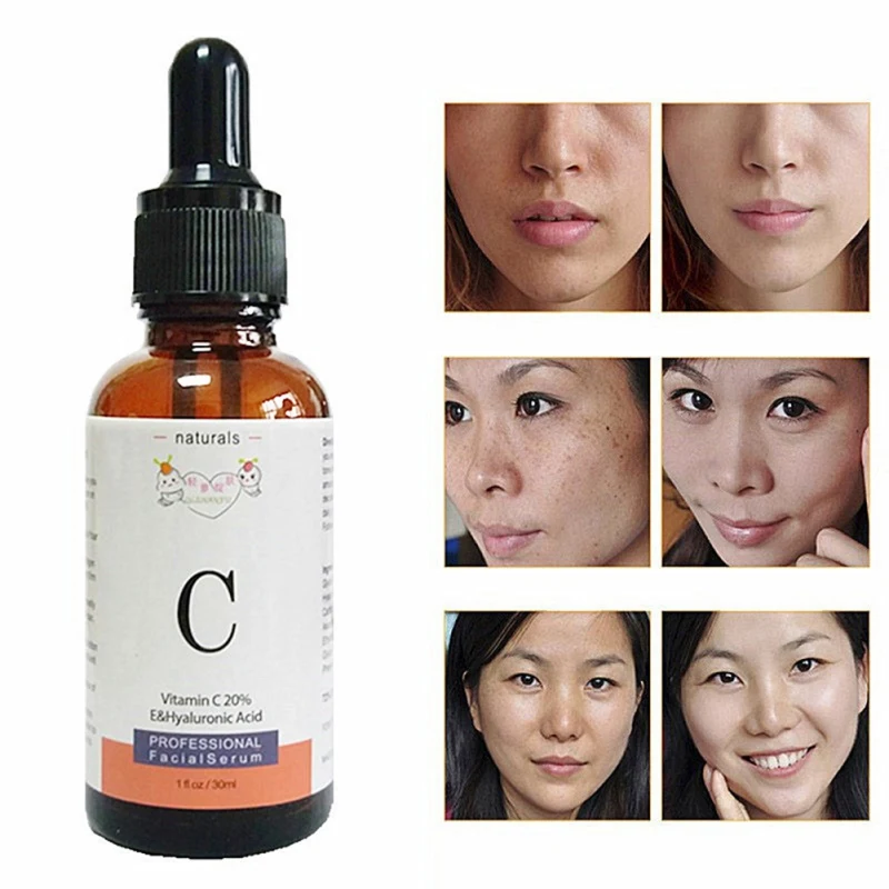 

Remove Dark Spots Essence Dilute Spots Hyaluronic Acid Facial Moisturizing Essential Oil Vitamin C Liquid Moisturizing Essence