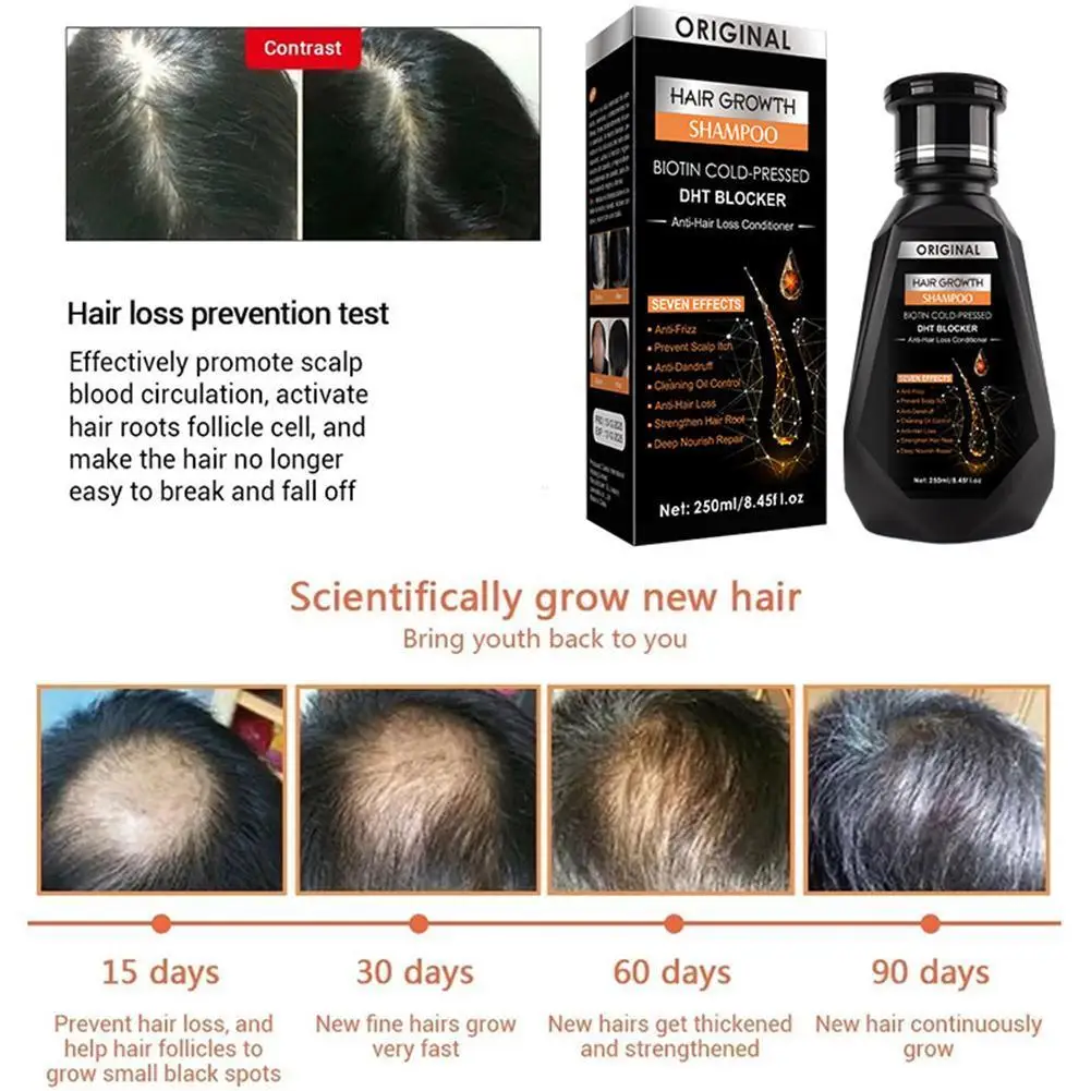 

Имбирный шампунь 250 мл масло для роста волос Продукты для быстрого роста волос лечение кожи головы Предотвращение выпадения волос филировк...