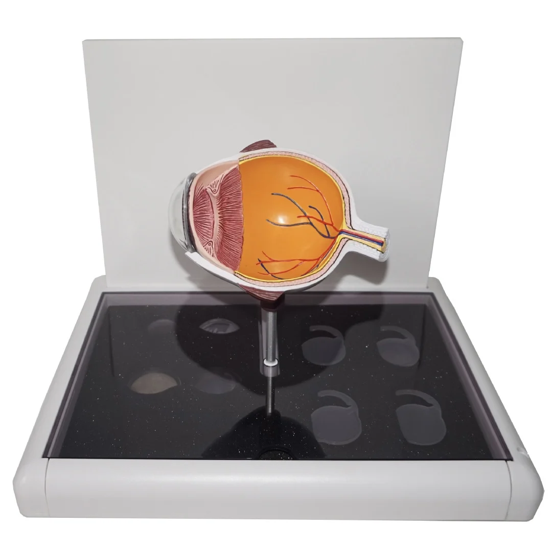 

Cataract Eyeball Eyeball Model