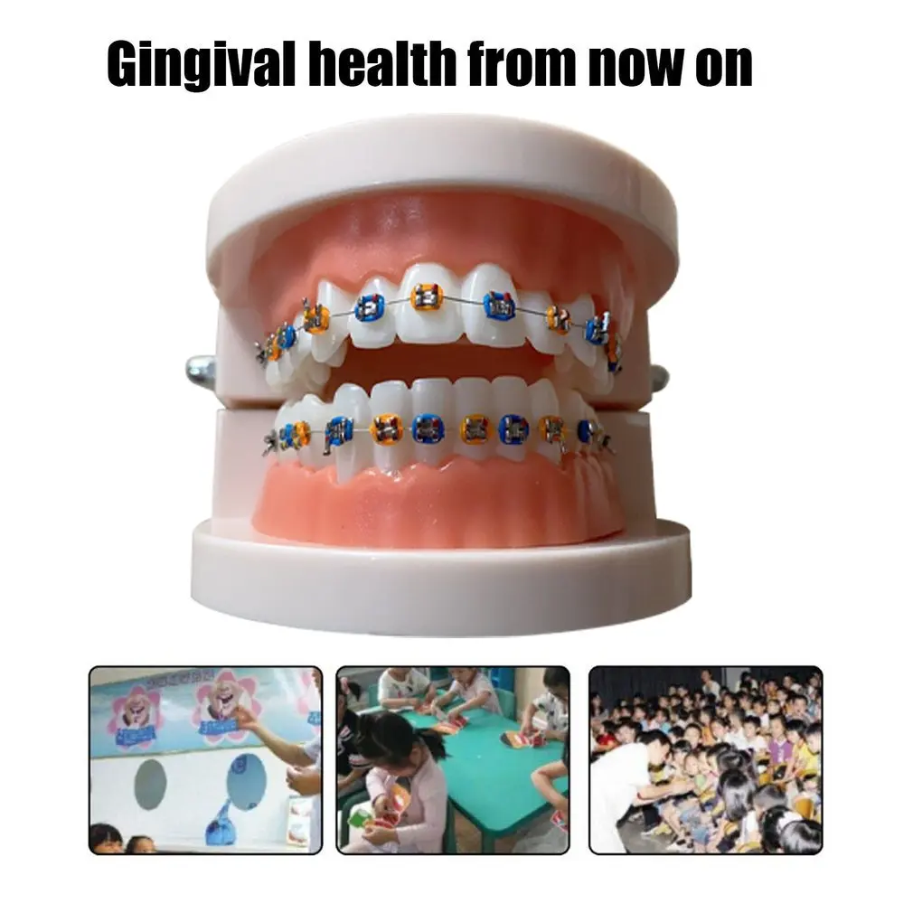 

Universal Portable Tooth Model Dental Materials Orthodontic Model Dental Equipment Metal Brackets Orthodontic Model