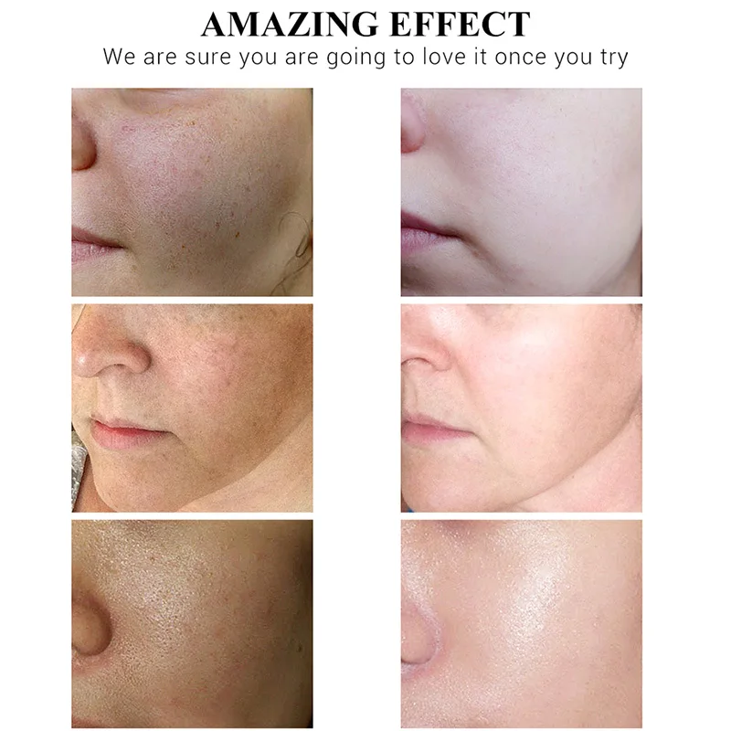 

Brightens And Revitalizes Delicate Moisturizing Water Vitamin C 50g Skin Care Cream VC Fine Lines Lightening Skin