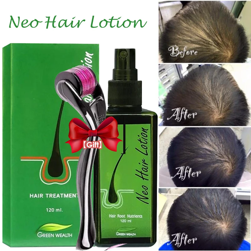 

Neo Hair Lotion Herbs 100% Natural Treatment Spray Stop Hair Loss Root BEARD SIDEBURNS LONGER Nutrients MSDS Report Support