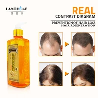 300ml professional hair ginger shampoo for hair growth hair regrowth dense fast thicker shampoo anti hair loss dandruff product