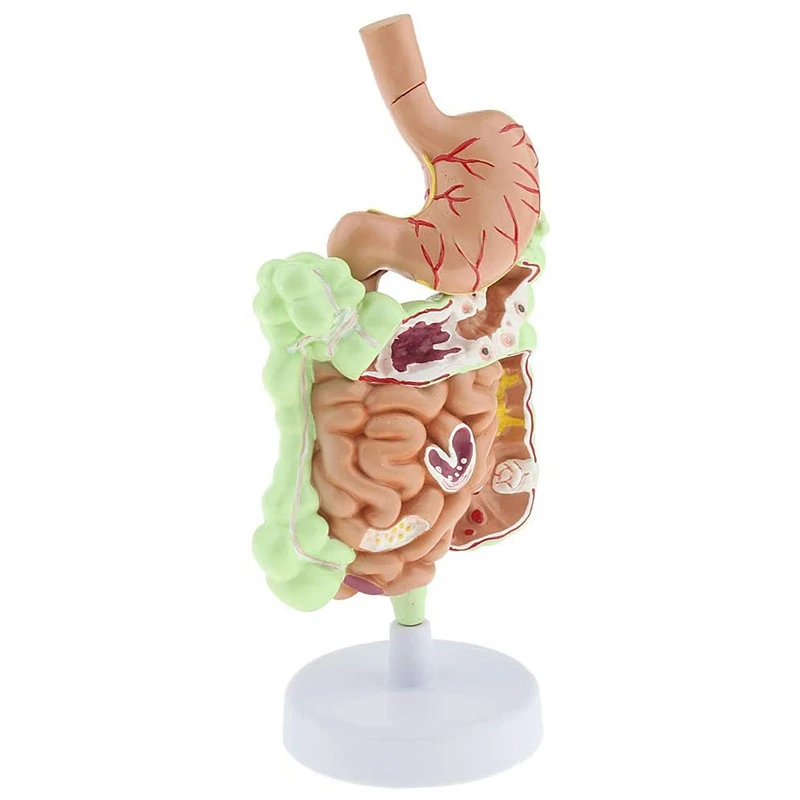 Натуральная модель человеческой пищеварительной системы анатомия желудка