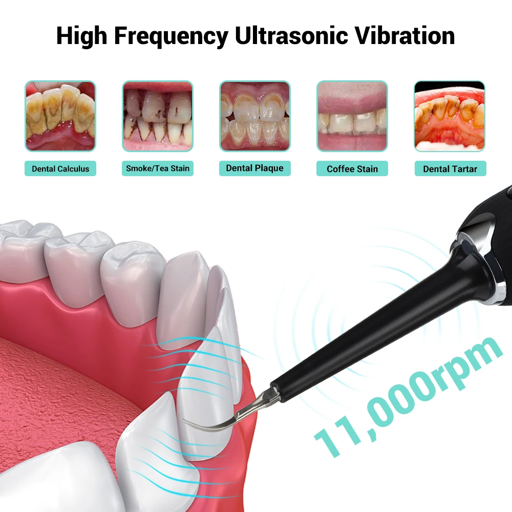 Ultrasonic Calculus Remover Electric Tartar Whitening USB Rechargeable Tooth Cleaner Oral Hygiene Tool | Бытовая техника