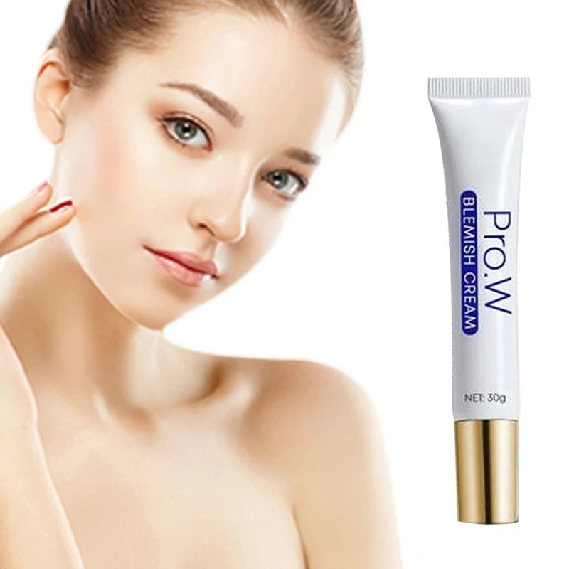30g Face Blemish Freckle Cream Pimple Acne Treatment Scar Dark Spots Removal U2JD