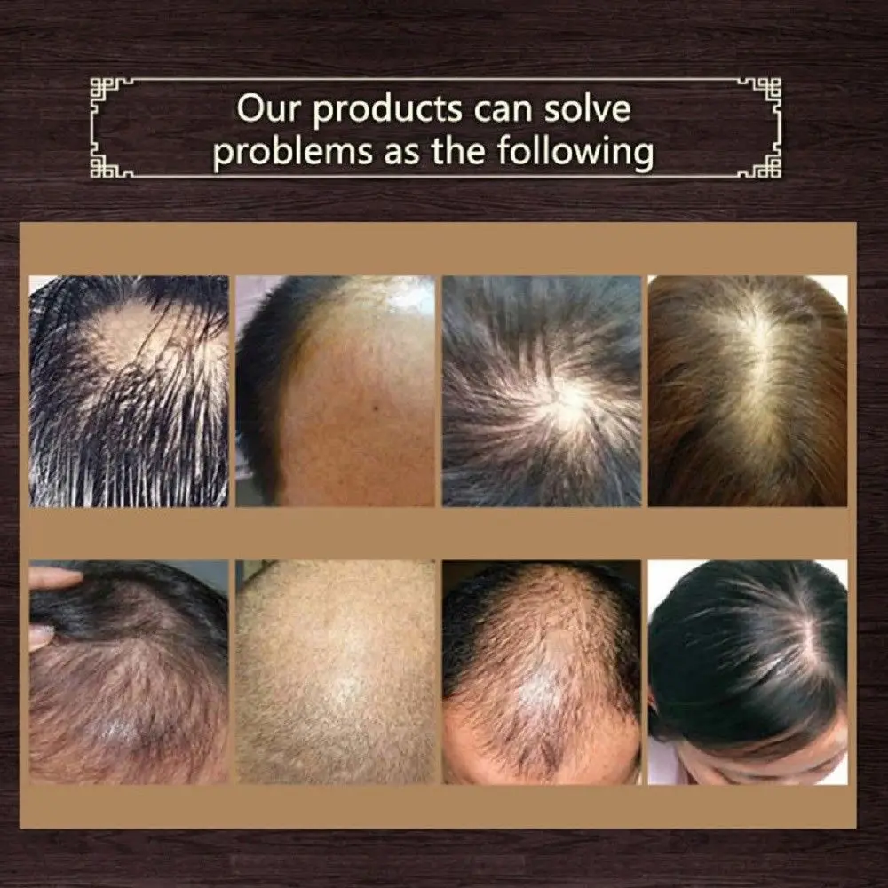 Чистые касторовые быстромощные средства с эссенцией для роста волос эфирное