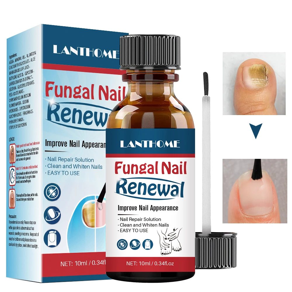 

LANTHOME Fungal Nail Renewal Anti Fungus Nails Solution Clean Whiten Nail Nourish Revive Nail Discolorations Regenerate Toe Nail