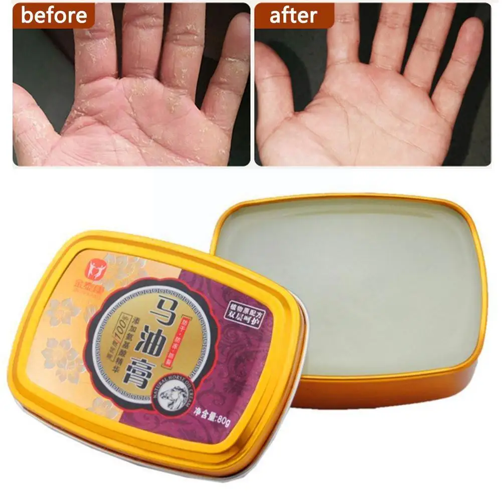 

Horse Oil Ointment Hand Cream Anti-dry, Cracking, Oil Moisturizing And Snake Ointment Hydrating Frostbite H6Q7