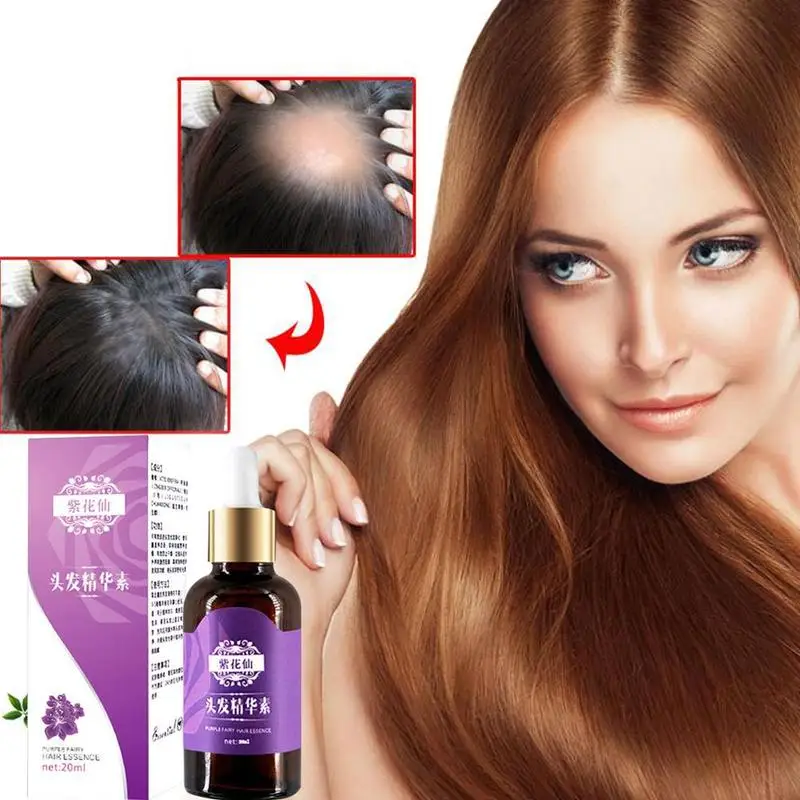 

Hair growth essence hairline hair growth essence essence oil hair loss treatment for men and women