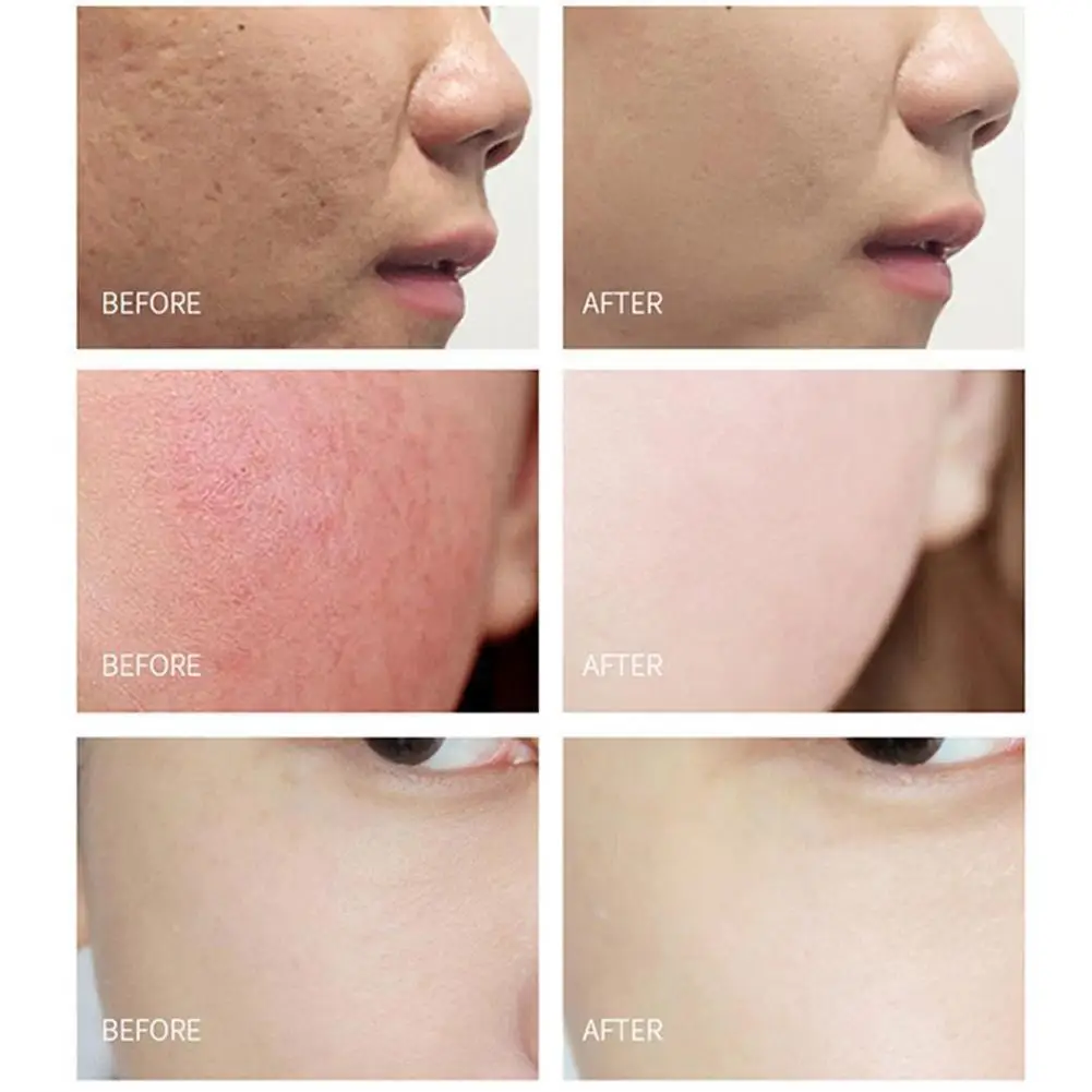 

Repair Freeze-Dried Powder Face Serum Shrink Pores Lifting Essence Repair Anti Pore Moisturizing Aging Skin Care Firming J1T7