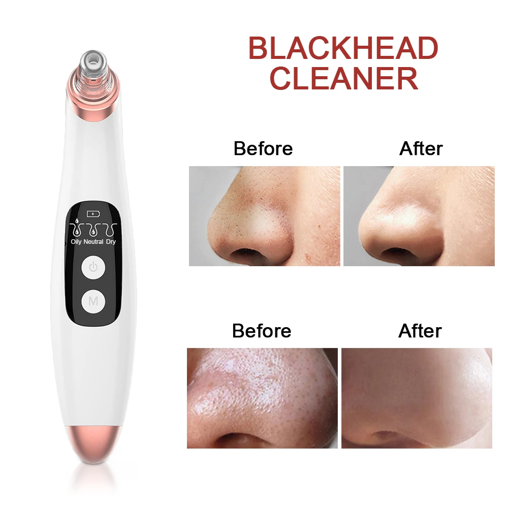 

Blackhead Remover Vacuum Suction Pore Cleaner Machine Extractor Black Bot Pimples Acne Face Skincare Tools Beauty Facial Machine