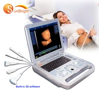 high performance sonography medical veterinary 3d ultrasound pet cow pregnancy test machine